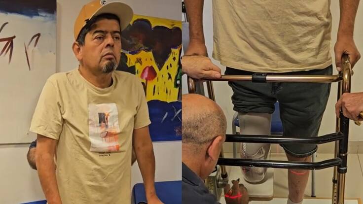 Mostró su nueva prótesis: Mauricio Medina expone cómo ha sido el difícil proceso de su rehabilitación tras la amputación de la mitad de su pierna