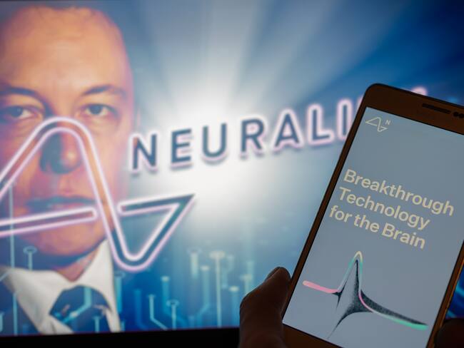 Elon Musk confirma exitoso implante de chip Neuralink en un ser humano: resultados iniciales son “prometedores”