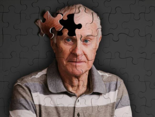 Descubren al menos cinco variantes para la enfermedad de Alzheimer