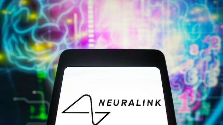 Elon Musk asegura que paciente con chip cerebral de Neuralink logró mover el cursor de un mouse con el pensamiento